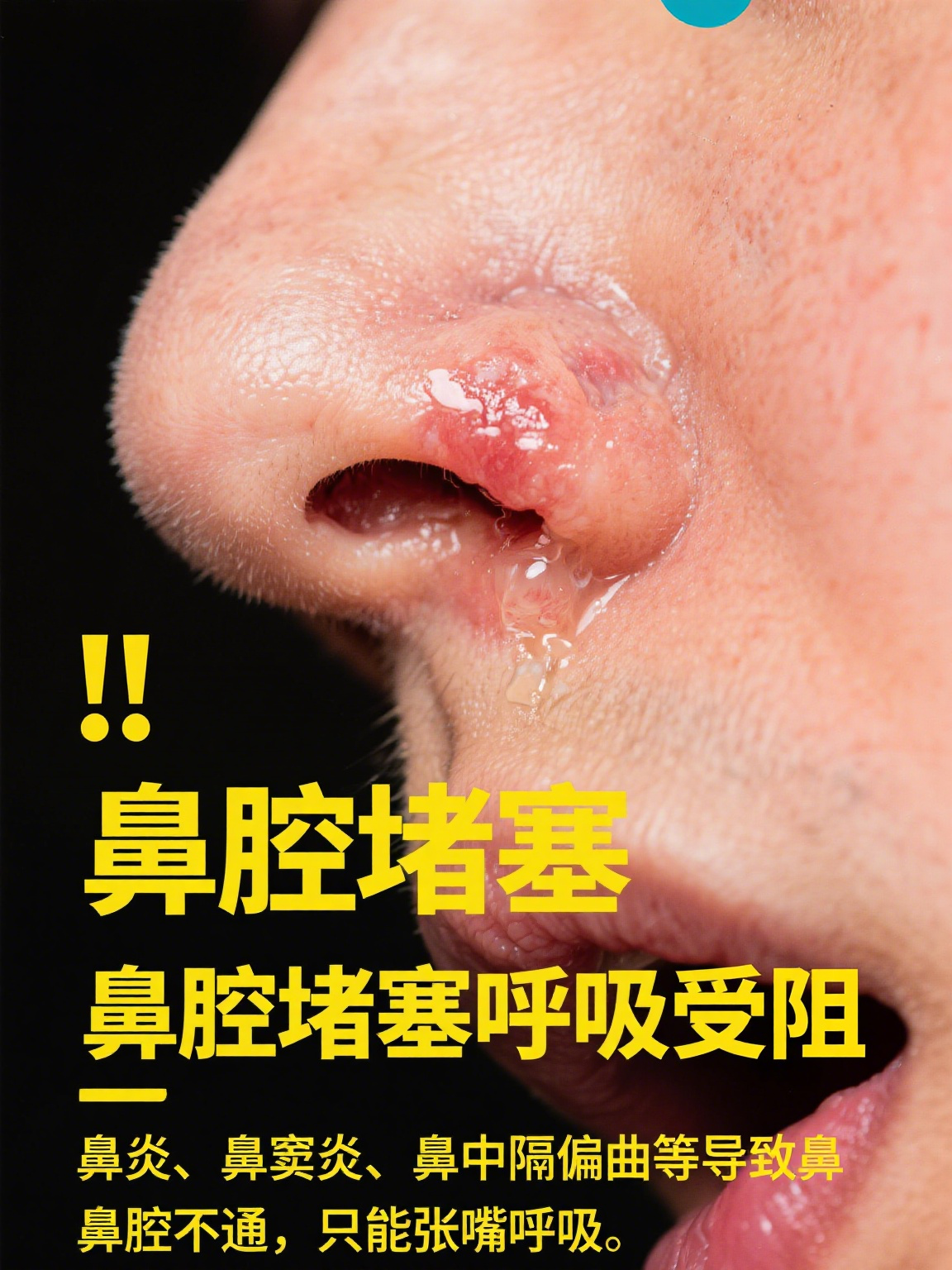 关于	洞Du?鼻&?{胧梿匟>z的信息